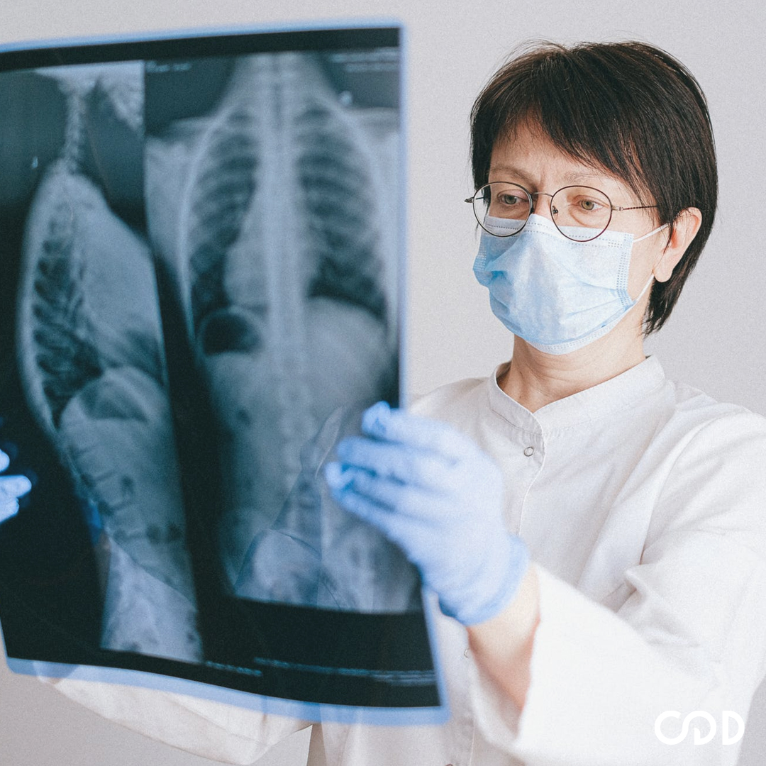 Enfisema, DPOC e câncer de pulmão: quais são as diferenças?