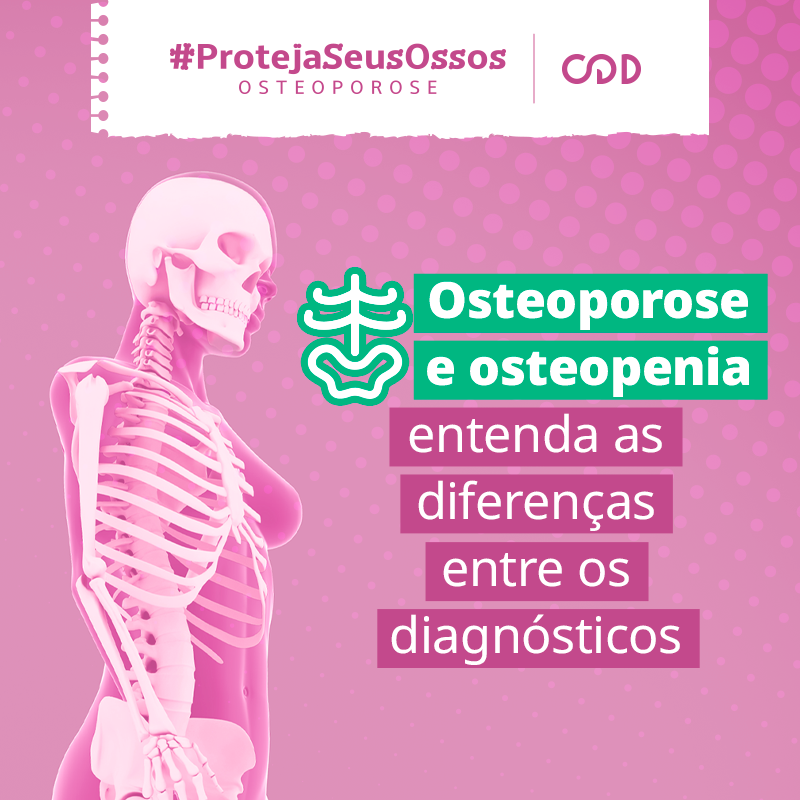 Osteoporose e osteopenia: entenda as diferenças entre os diagnósticos